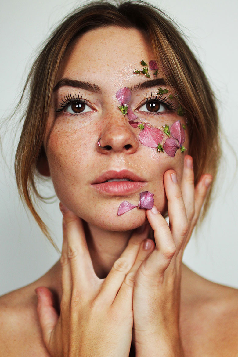 Skin Freckles